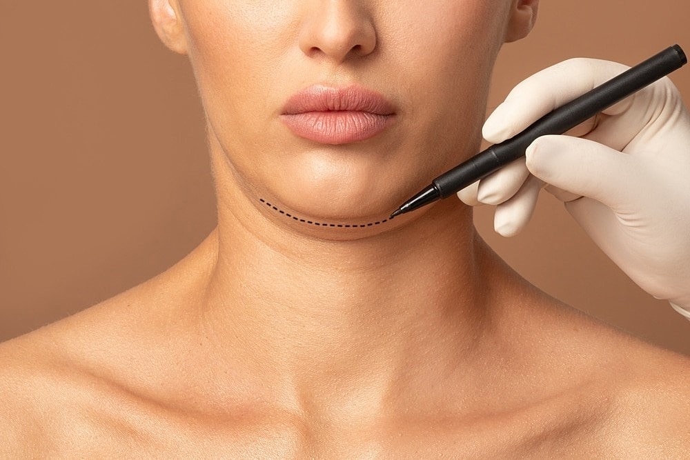 How Kybella® Works to Permanently Break Down Fat Cells