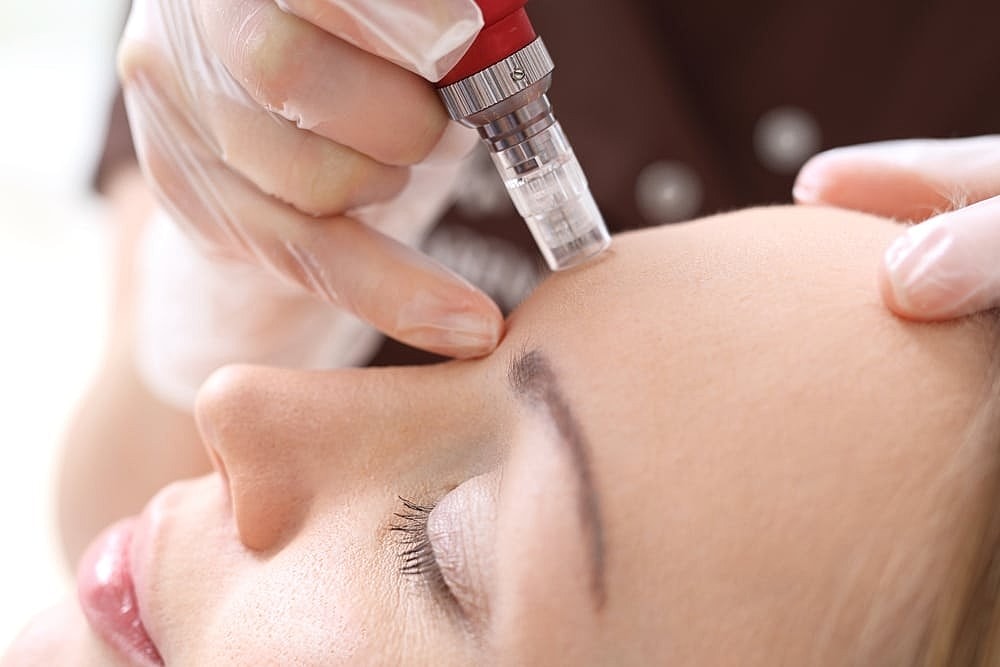 Microneedling for Scars: Effective Treatment Options in Salt Lake City
