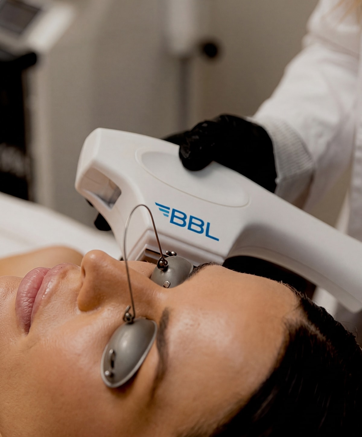 BBL treatment session on a woman's face.