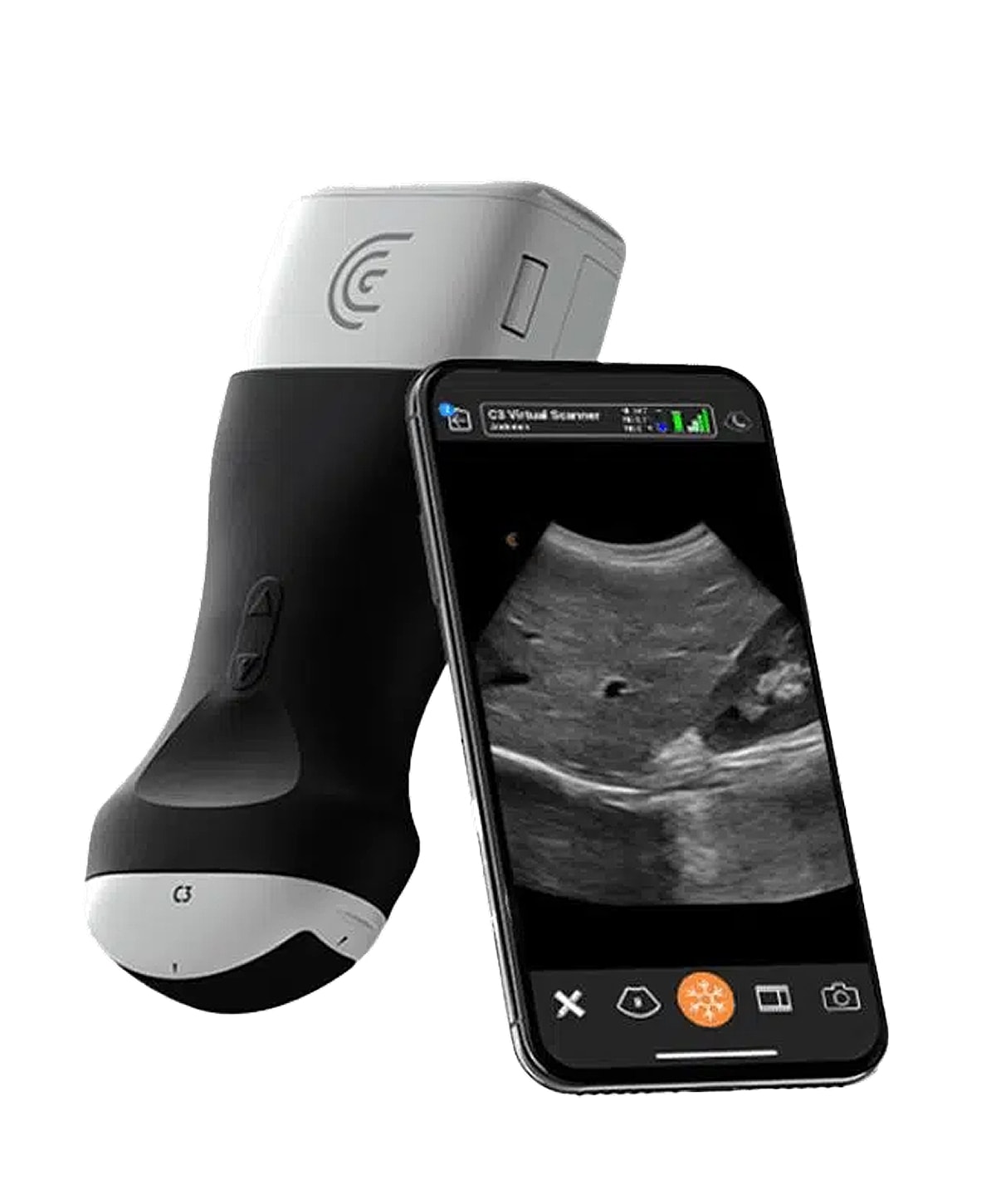 Portable ultrasound scanner with mobile connectivity.