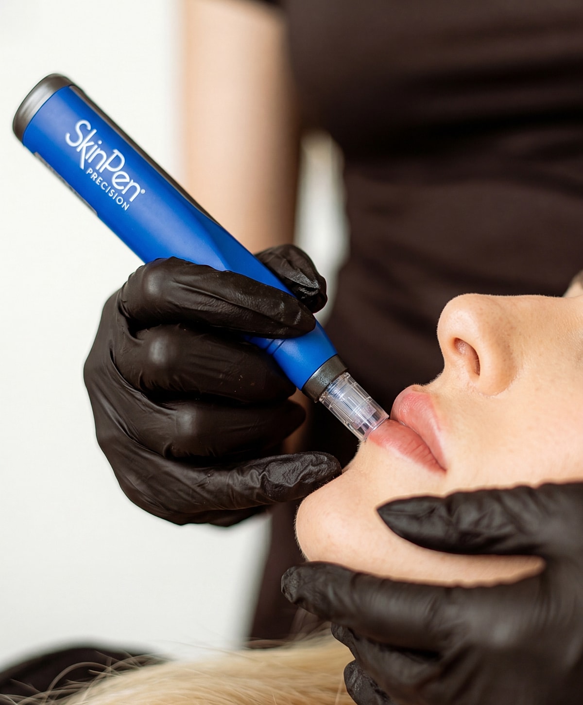 SkinPen treatment on lips by gloved professional.