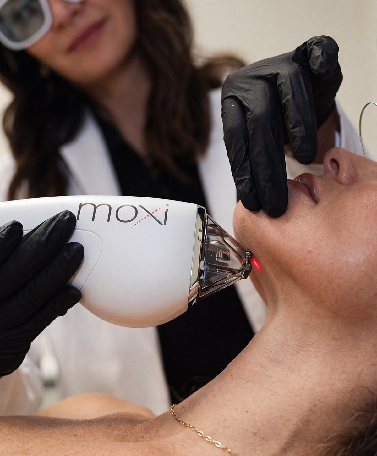 Moxi laser treatment on a woman's neck.