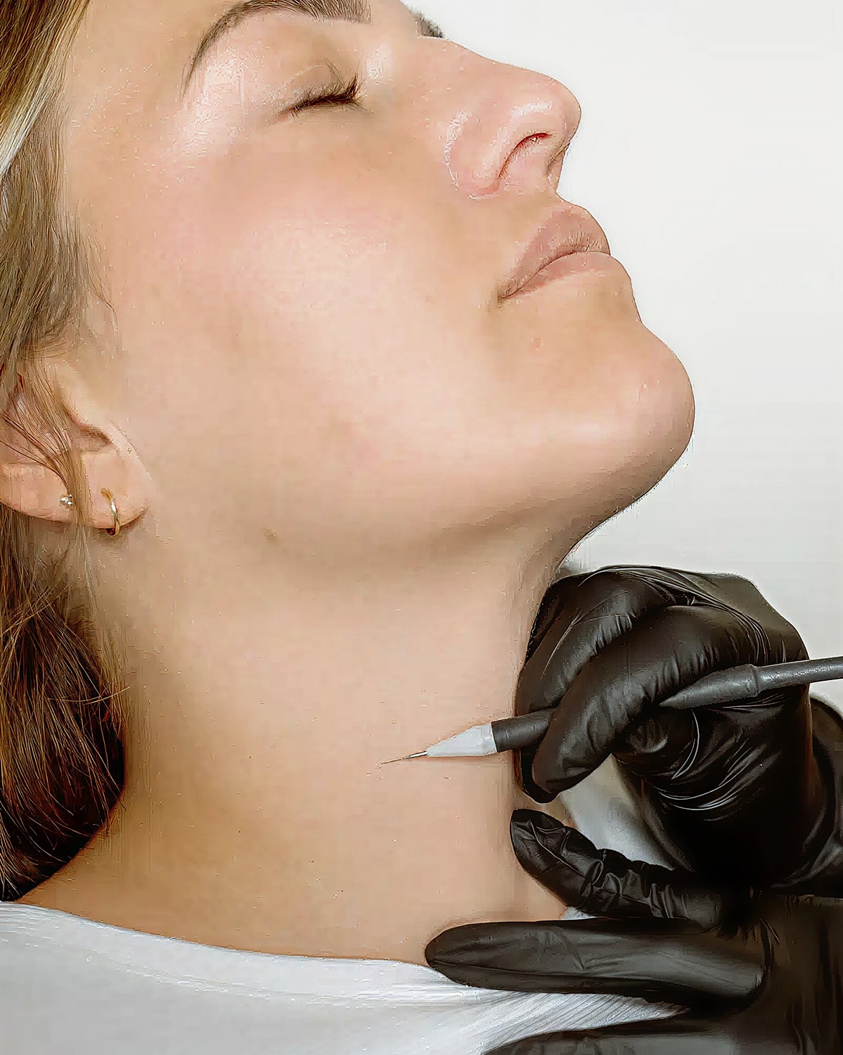 Beauty treatment in progress on model's neck.