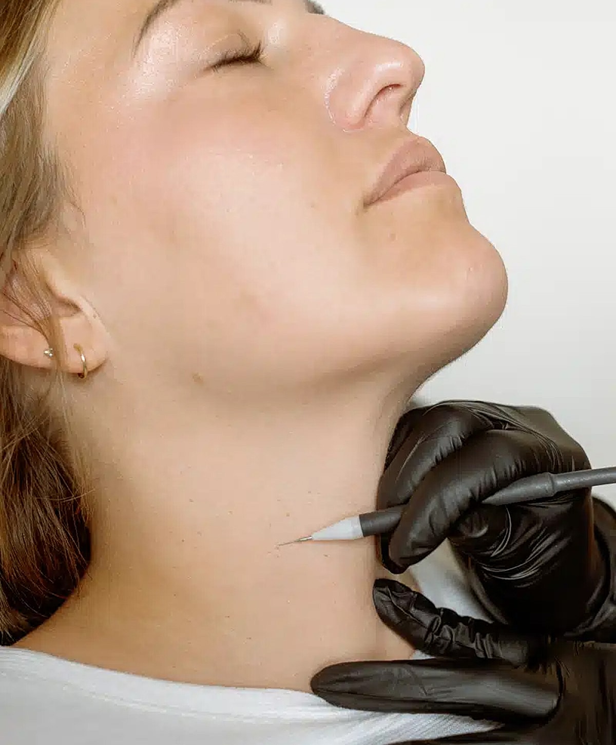 Cosmetic treatment being applied to woman's neck.