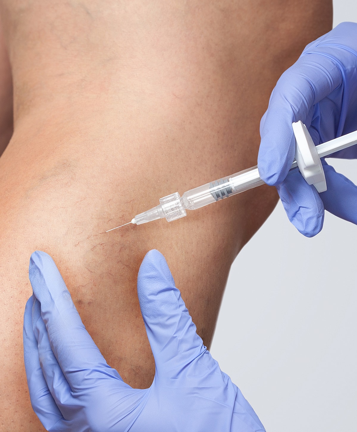 Injection being administered to a knee.